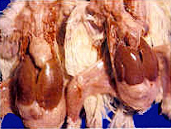 Pericarditis por salmonella