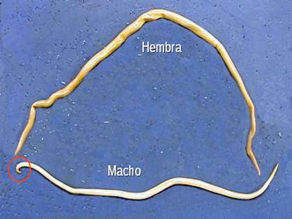 Ascaridiosis cecal