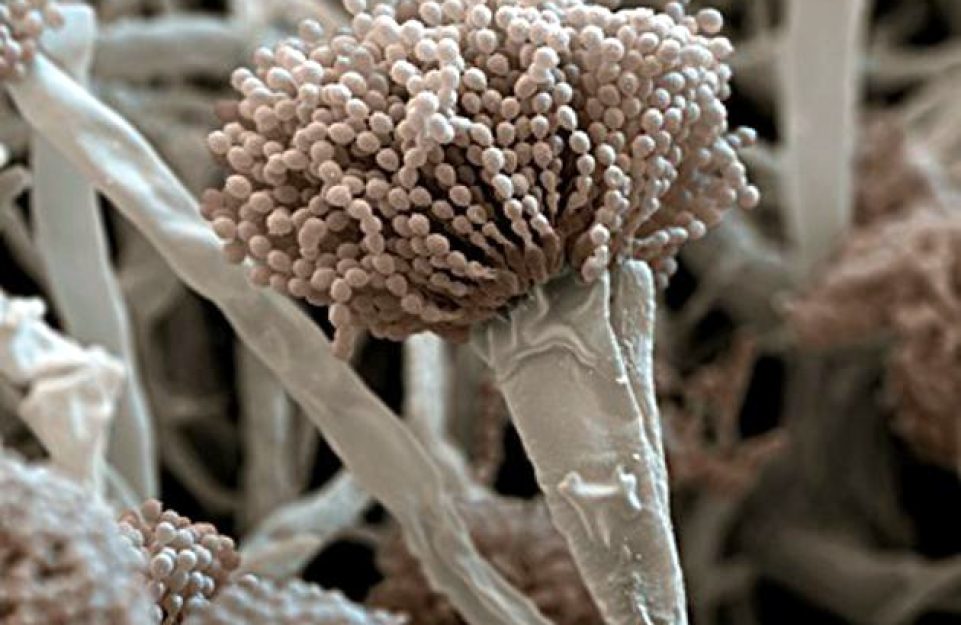 Micro-grafía electrónica Aspergillus fumigatus