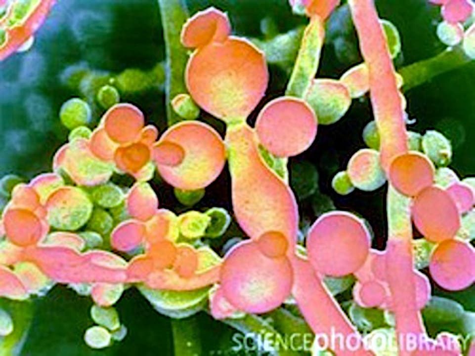 Micrografia electrónica de barrido (SEM) del hongo Candida albicans.