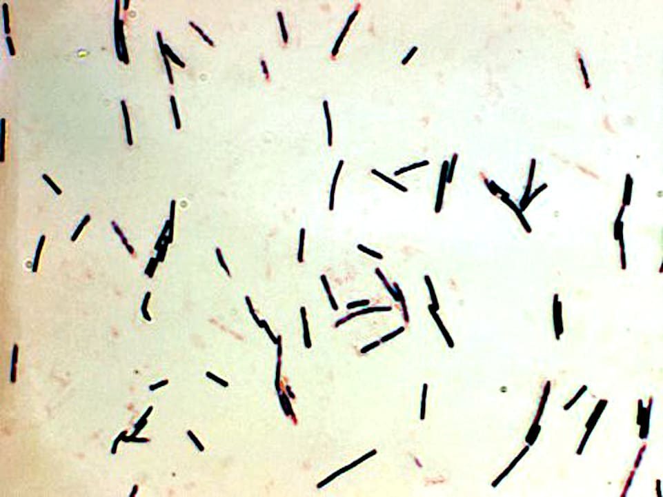 Enteritis necrótica causado por Clostridium perfringens