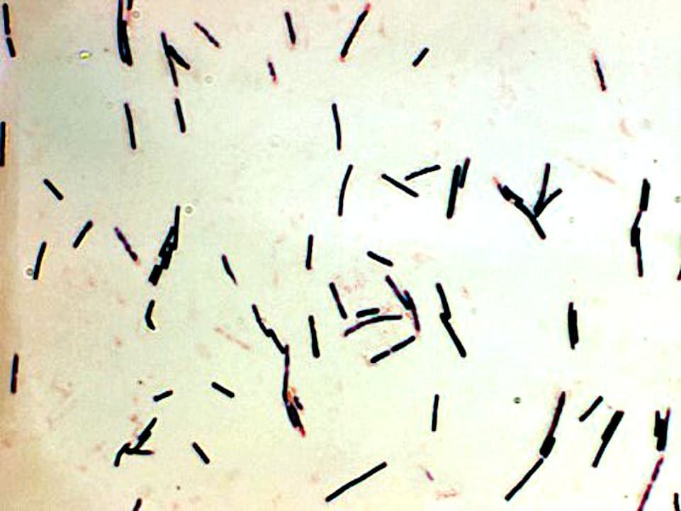 Enteritis necrótica