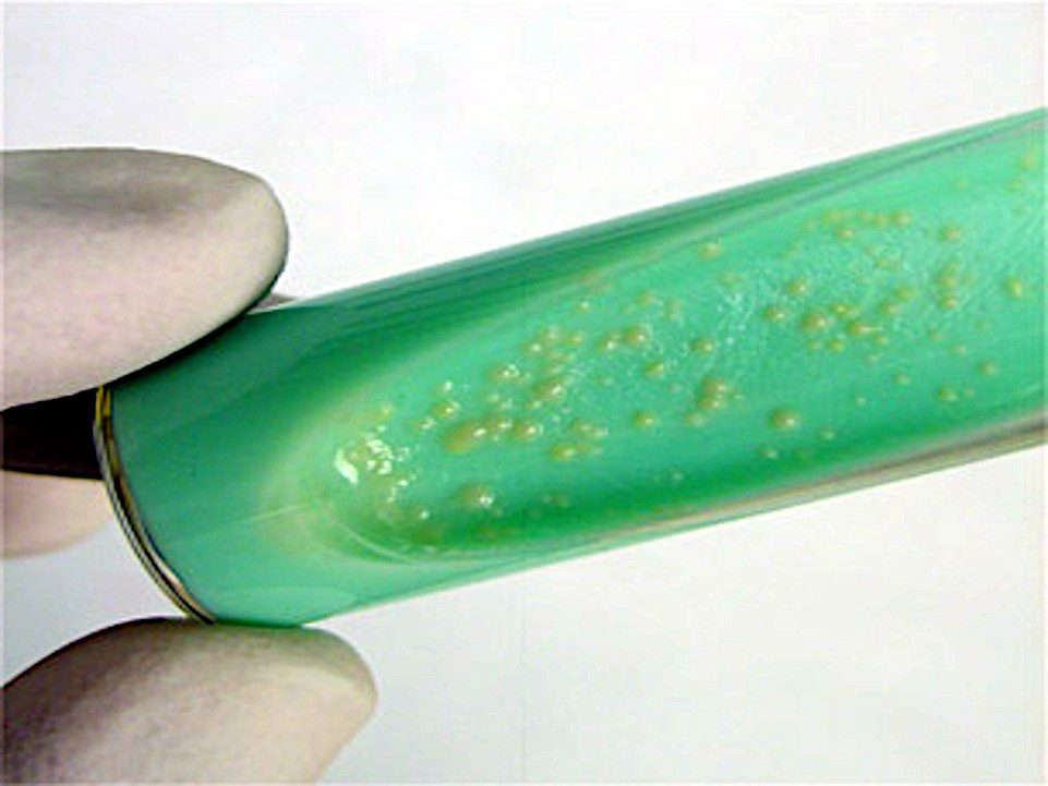 Mycrobacterium avium creciendo