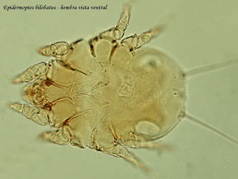 Epidermoptes bilobatus hembra vista ventral