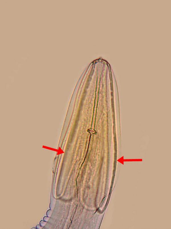 Espécimen adulto del nematodo digestivo Synhimantus