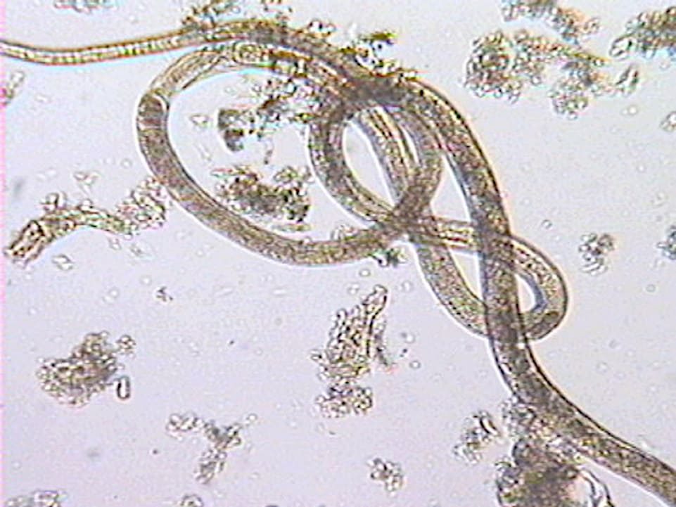 Gusanos adultos de Capillaria