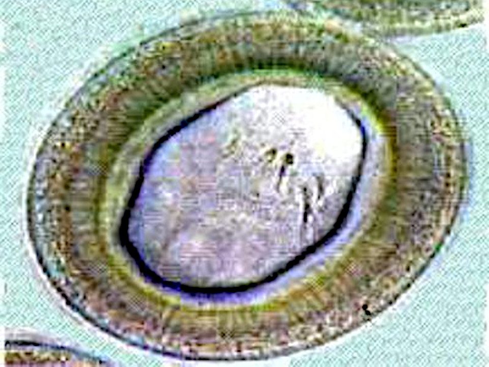 Huevo del genero Taenia