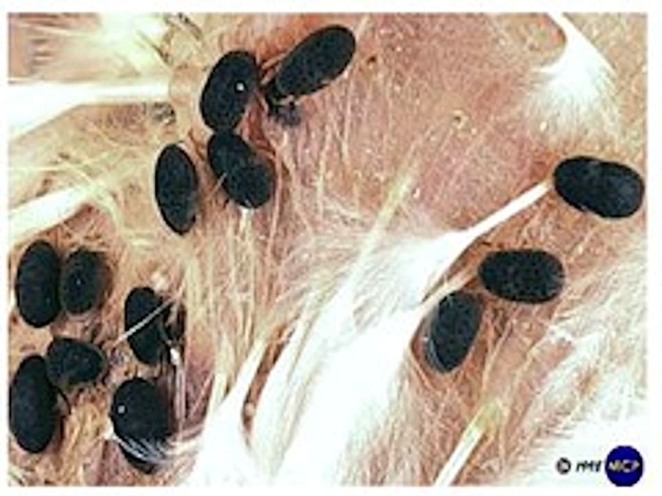 Larvas Garrapata, Borrelia Anserina
