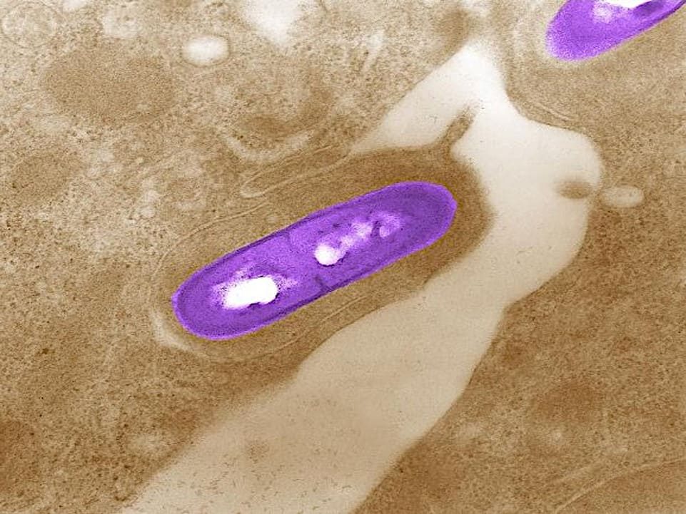 Listeria monocytogenes