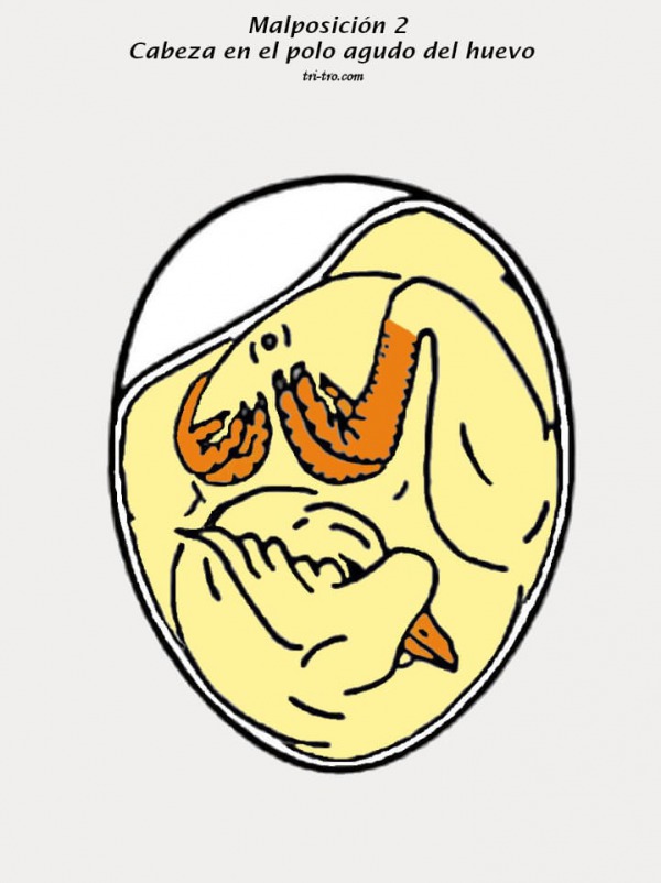 Malposición 2 Cabeza en el polo agudo del huevo.