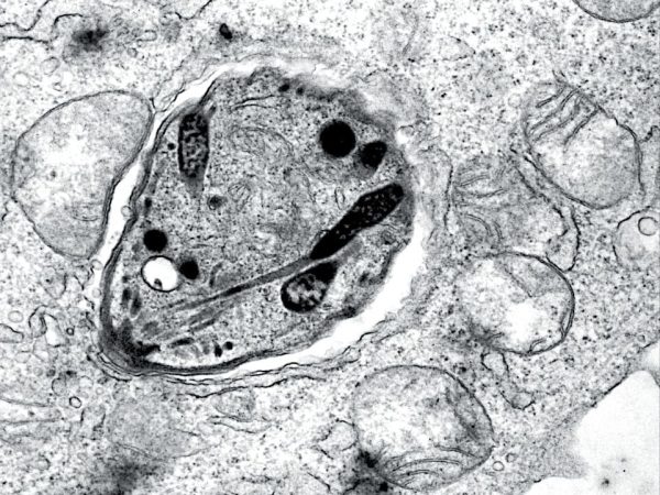 mycoplasma gallisepticum microscopio bacteria respiratoria aves