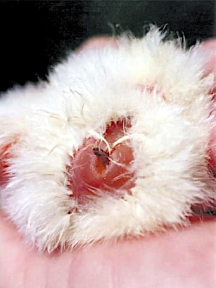 Ombligo mal cicatrizado: Onfalitis