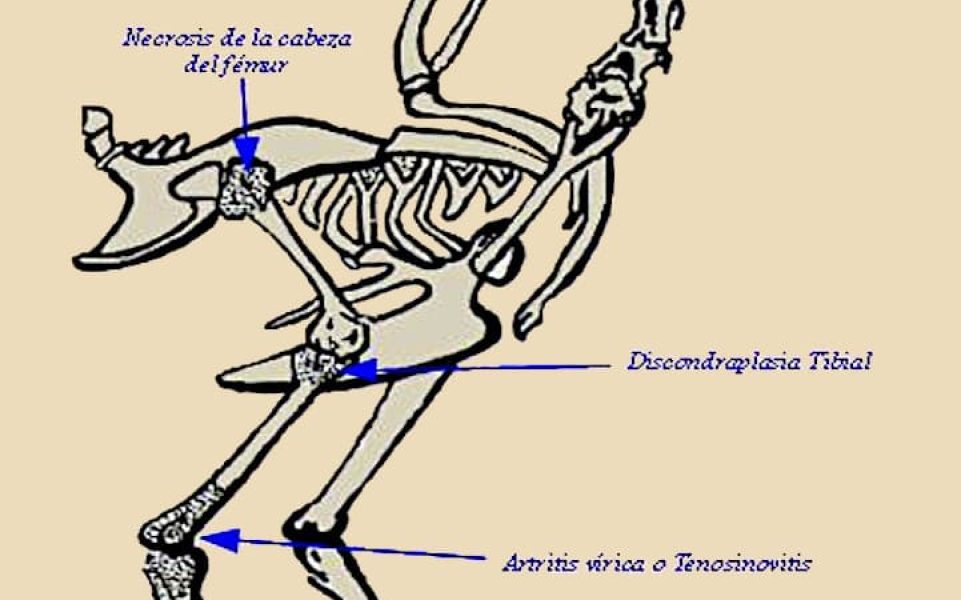 Artritis viral, sindrome de malabsorción