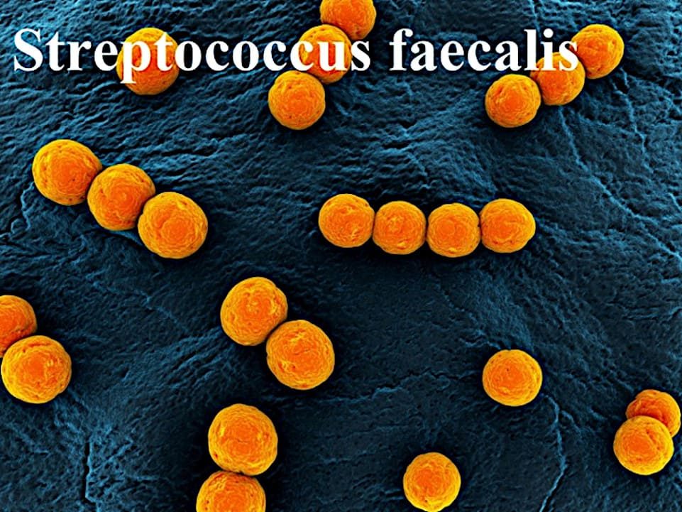Streptoccocus faecalis