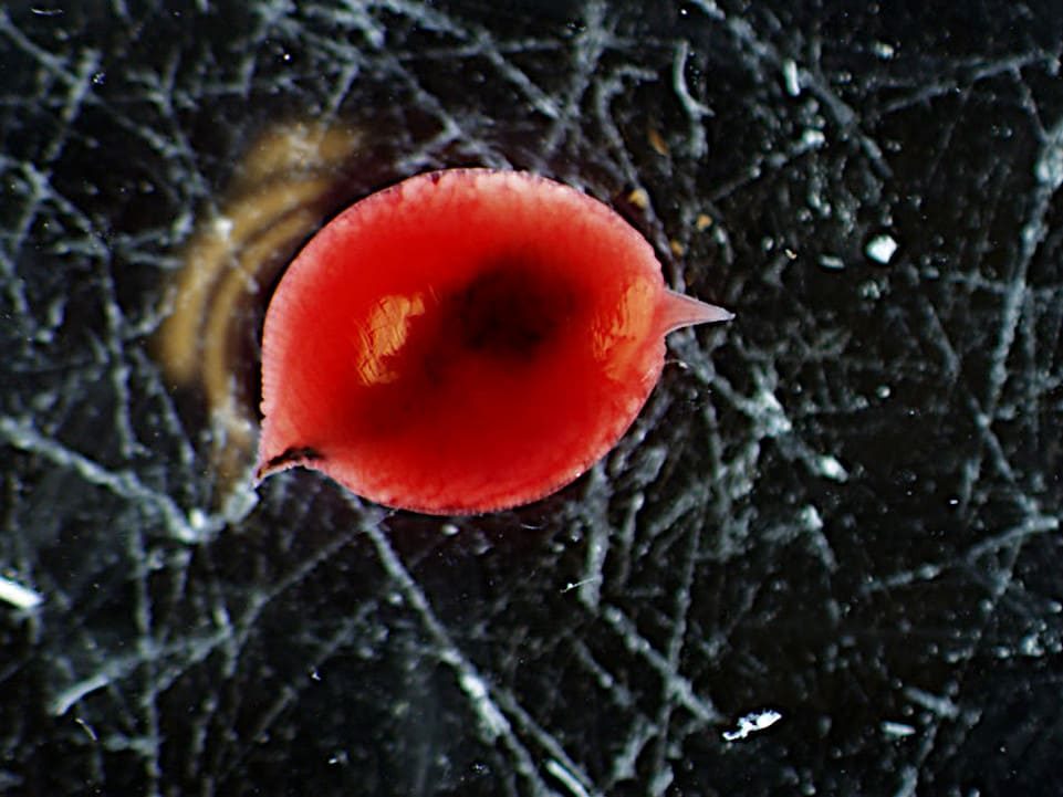 Tetrameres hembra