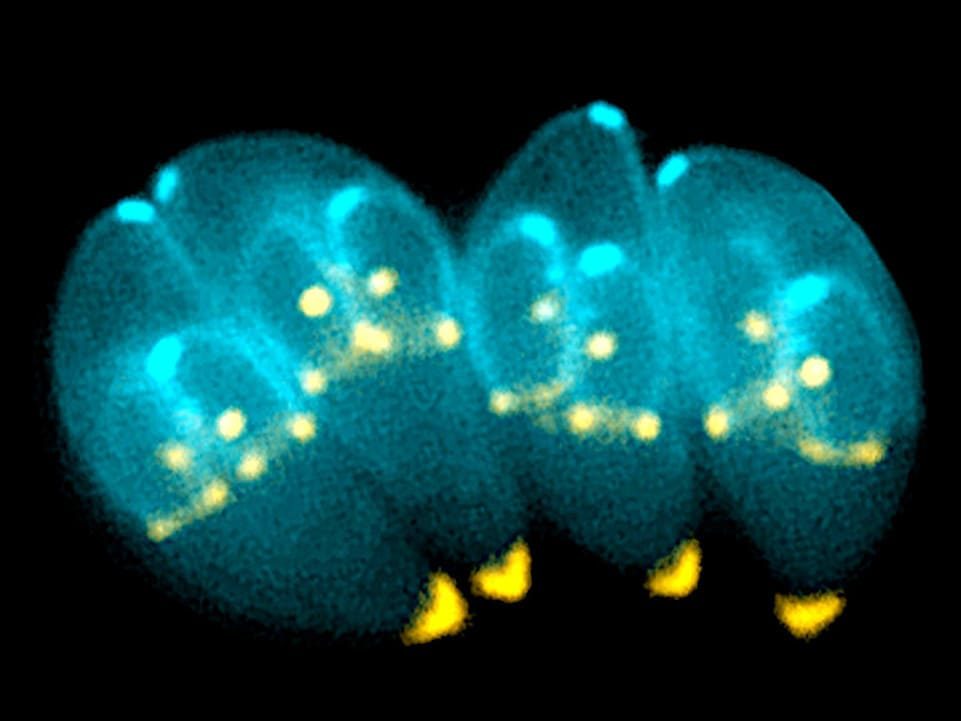 Toxoplasmosis.
