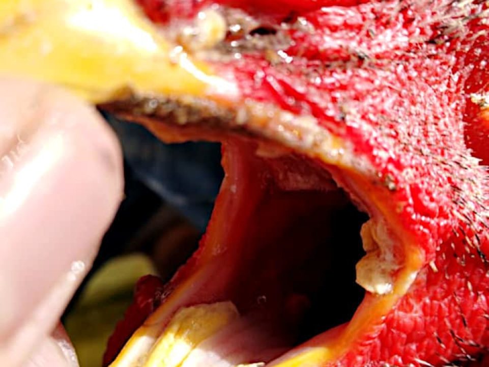 Tricomoniasis.