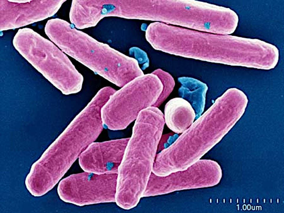 Mycrobacterium avium.