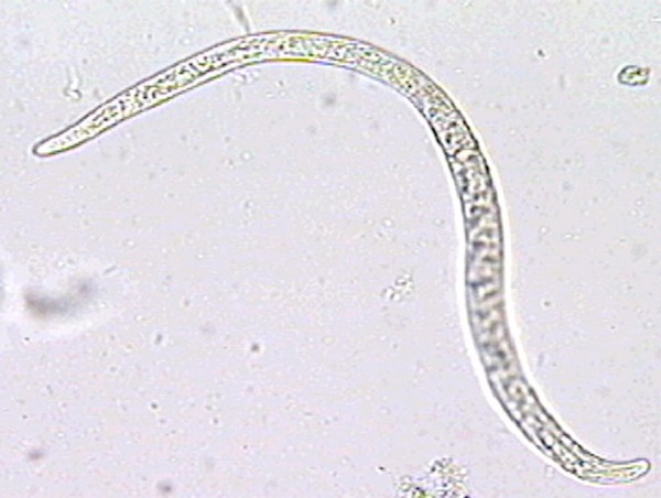 Larvas de Capillaria